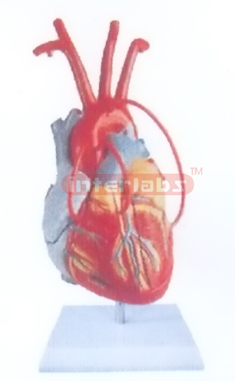 MIDDLE HEART MODEL WITH BYPASS